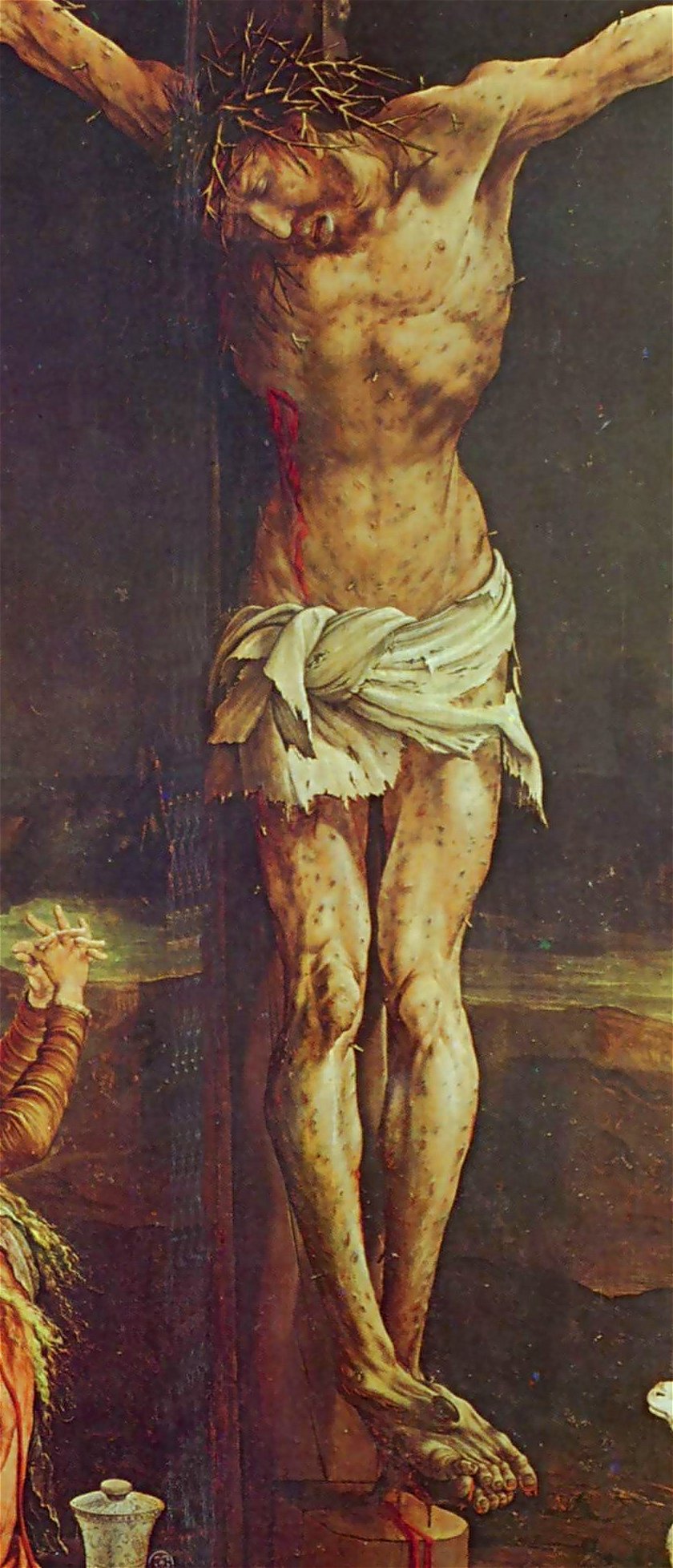 Isenheimer Altar - Jesus mit Symptomen der Kriebelkrankheit oder Antoniusfeuer